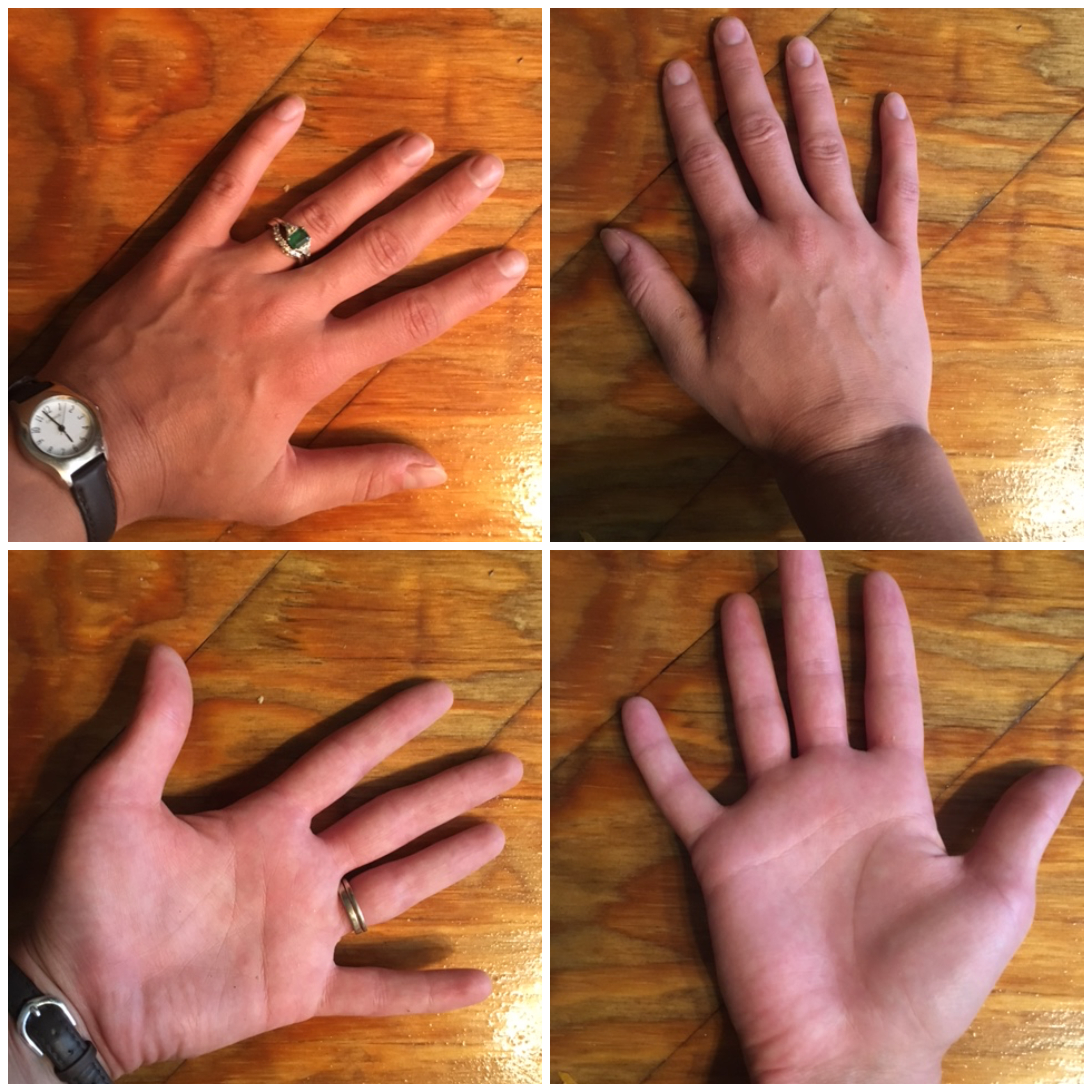 Hand Image